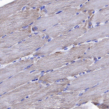 NDUFA9 Recombinant Mouse mAb (S-5382)
