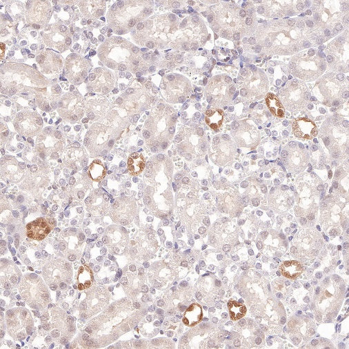 S100A11 Recombinant Rabbit mAb (S-821-4)