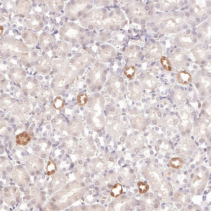 S100A11 Recombinant Rabbit mAb (S-821-4)