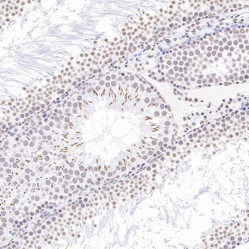 Histone H3 (mono methyl K79) Recombinant Rabbit mAb (S-R417)
