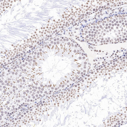 Histone H3 (mono methyl K79) Recombinant Rabbit mAb (S-R417)