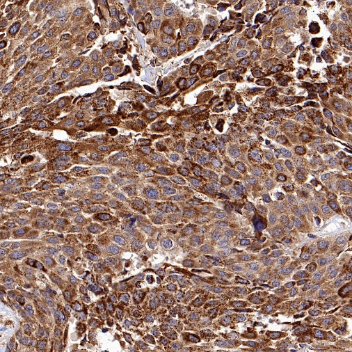Hexokinase II Rabbit Polyclonal Antibody