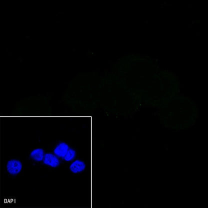 CD44 Recombinant Rabbit mAb (SDT-R107)