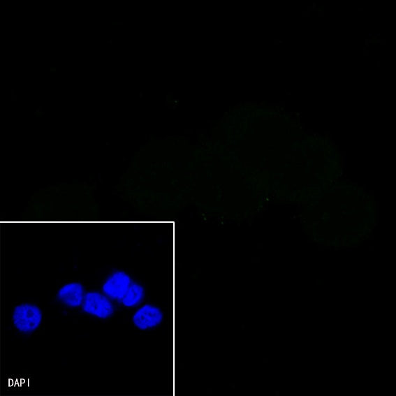 CD44 Recombinant Rabbit mAb (SDT-R107)