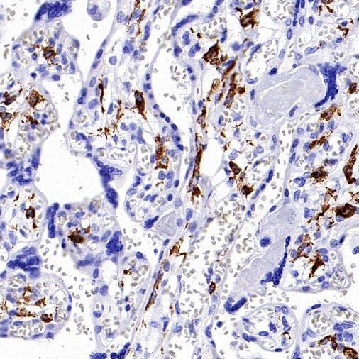 Mannose Receptor Recombinant Rabbit mAb (SDT-2206-59)