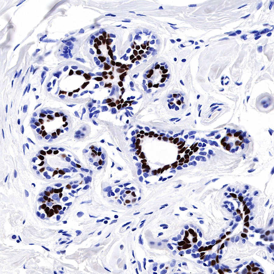 Progesterone Receptor Recombinant Rabbit mAb (SDT-R123)