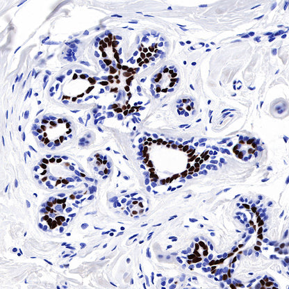 Progesterone Receptor Recombinant Rabbit mAb (SDT-R123)