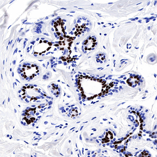 Progesterone Receptor Recombinant Rabbit mAb (SDT-R123)