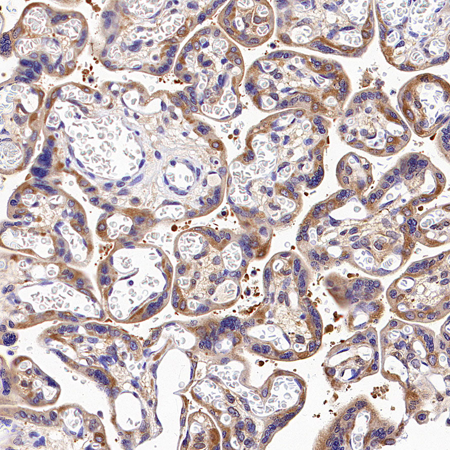 GAB1 Recombinant Rabbit mAb (S-3907-33)