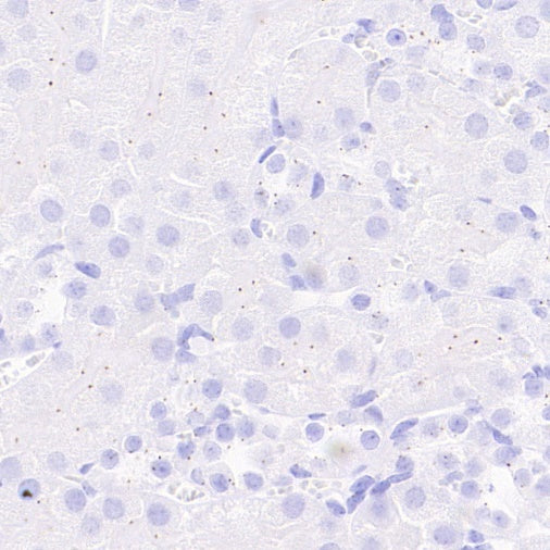 Pericentrin Recombinant Rabbit mAb (S-3493)