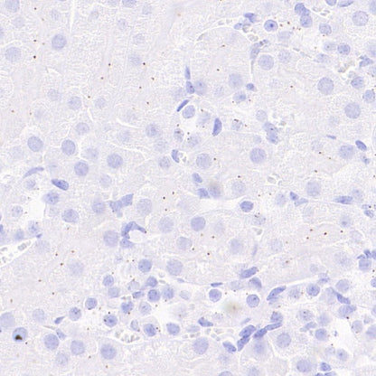 Pericentrin Recombinant Rabbit mAb (S-3493)