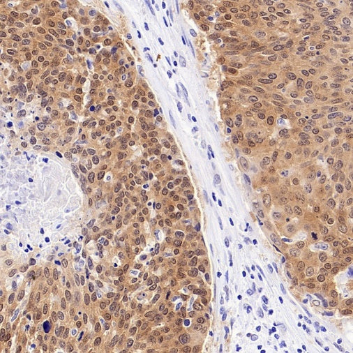 CDKN2A/p16 INK4A Recombinant Rabbit mAb (S-4676)