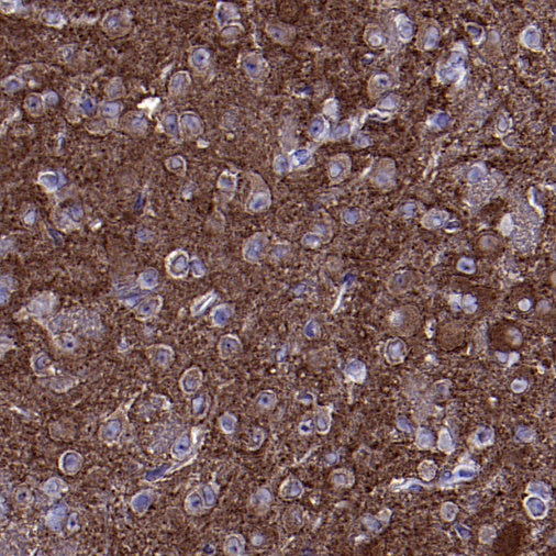 SDHA Recombinant Rabbit mAb (S-1458-43)