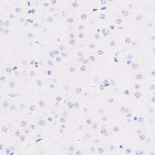Prolactin/PRL Recombinant Rabbit mAb (S-235-215)