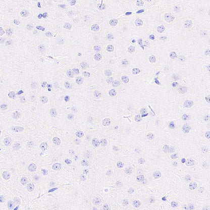 Prolactin/PRL Recombinant Rabbit mAb (S-235-215)