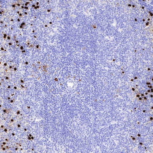 S100A8/MRP8 Recombinant Rabbit mAb (S-R251)