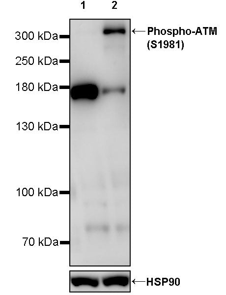 Phospho-ATM (Ser1981) Recombinant Rabbit mAb (S-3396)