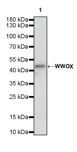 WWOX Recombinant Rabbit mAb (S-R298)