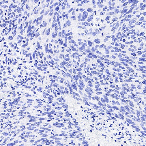 Histone H3.3 G34W Recombinant Rabbit mAb (SDT-6018)