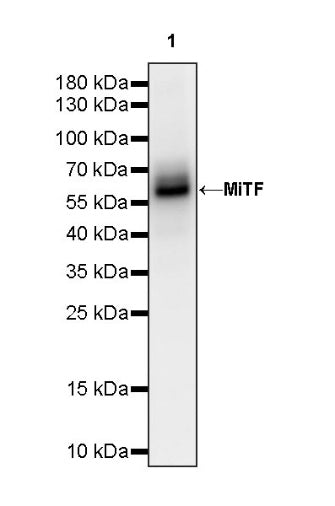 MiTF Recombinant Rabbit mAb (S-1047-50)