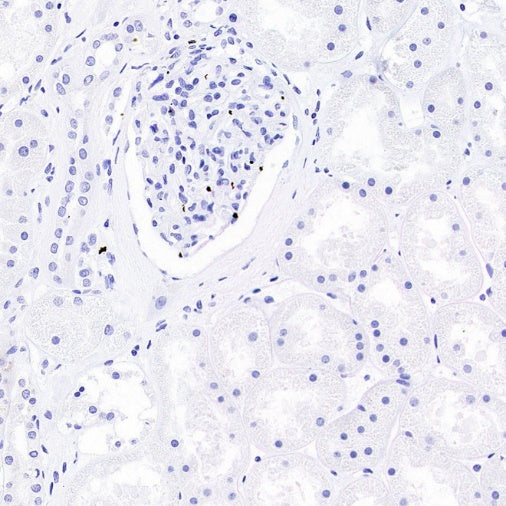 DAZL Recombinant Rabbit mAb (S-3113-35)