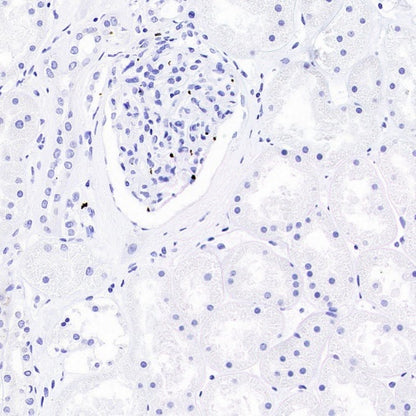 DAZL Recombinant Rabbit mAb (S-3113-35)