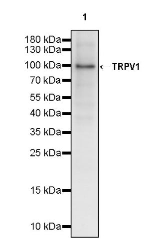 TRPV1 Recombinant Rabbit mAb (S-2021-75)