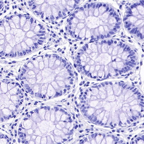 TACSTD2/TROP2 Recombinant Rabbit mAb (S-R237)