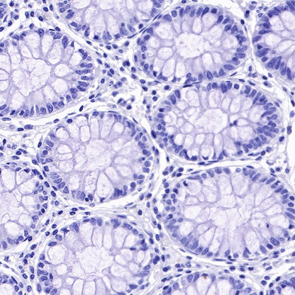 TACSTD2/TROP2 Recombinant Rabbit mAb (S-R237)