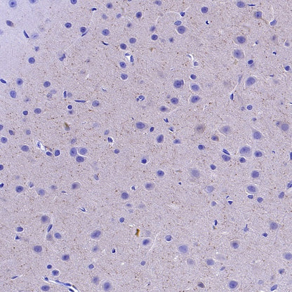 Choline Acetyltransferase/ChAT Recombinant Rabbit mAb (S-2561-17)