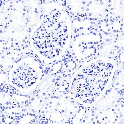 SNAP25 Recombinant Rabbit mAb (S-1828-67)
