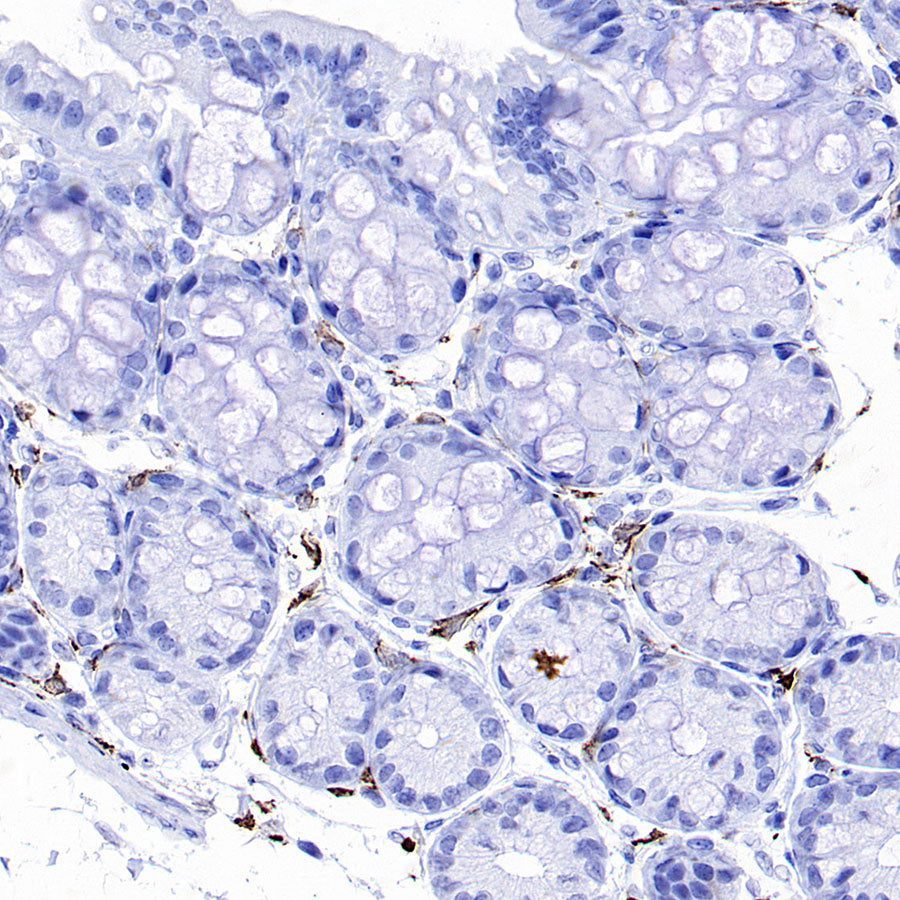 CD206 Recombinant Rabbit mAb (S-3477-27)