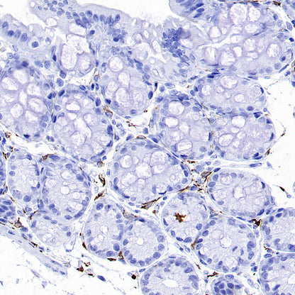 CD206 Recombinant Rabbit mAb (S-3477-27)