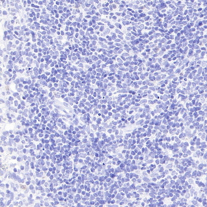 Mouse mAb IgG1, κ Isotype Control (S-844-79)