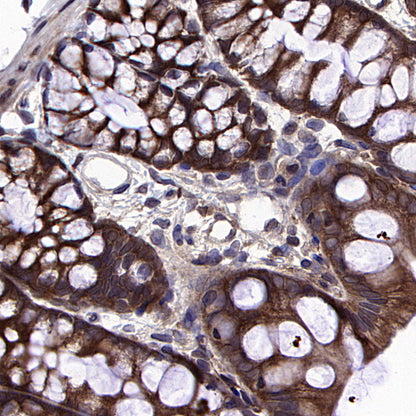 HSP90 Recombinant Mouse mAb (S-5484)