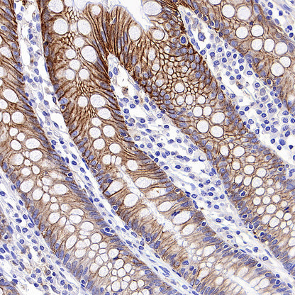 MCT1/Monocarboxylic acid transporter 1 Recombinant Rabbit mAb (S-5144)