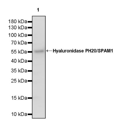 Hyaluronidase PH20/SPAM1 Recombinant Rabbit mAb (S-2143-20)