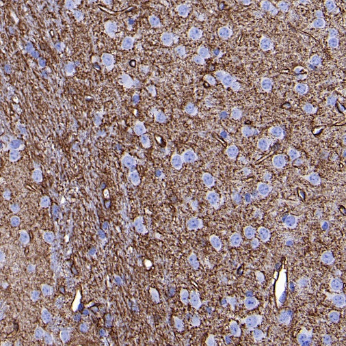 AQP4 Recombinant Rabbit mAb (S-1609-62)
