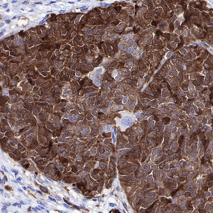 Stathmin 1 Recombinant Rabbit mAb (SDT-383-4)