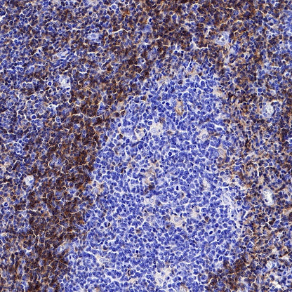 LAIR1 Recombinant Rabbit mAb (S-285-2)