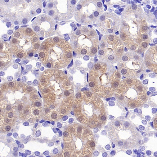 Prohibitin Recombinant Rabbit mAb (S-2679-7)