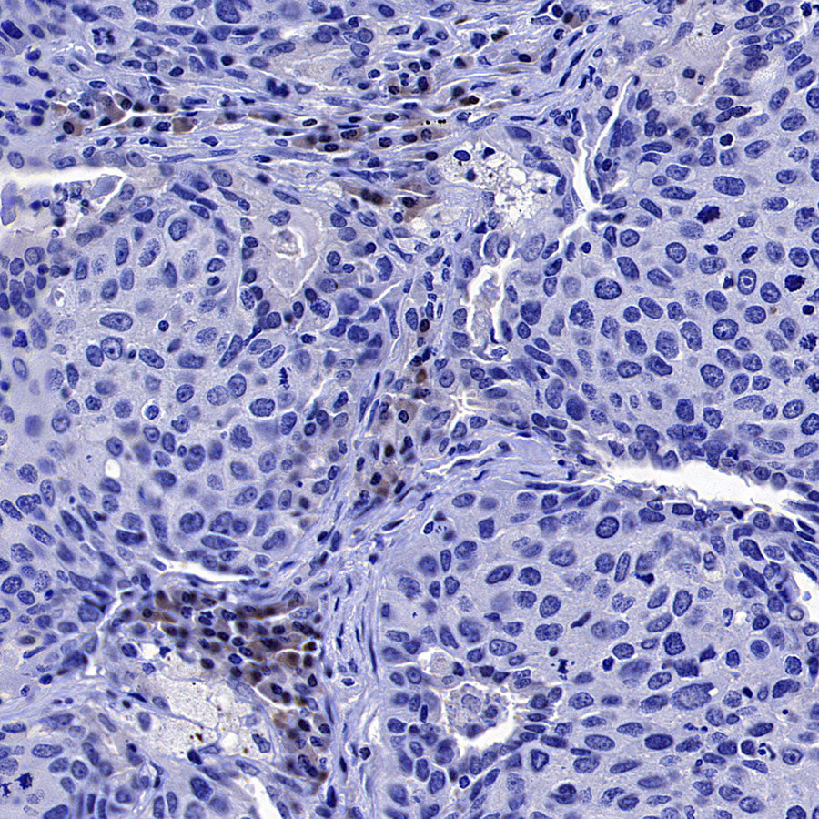GATA1 Recombinant Rabbit mAb (S-5401)