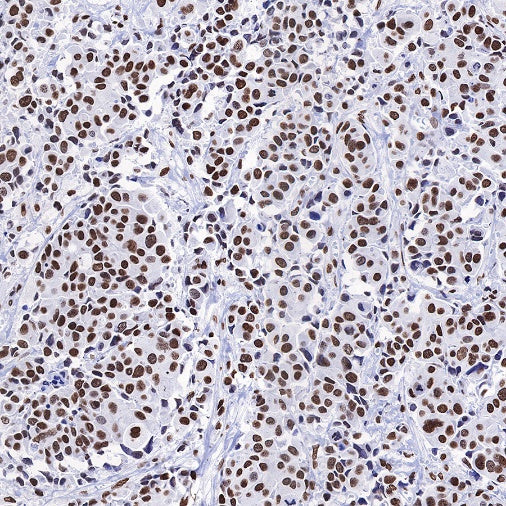 Histone H3 (acetyl K4 + K9 + K18) Rabbit polyclonal antibody