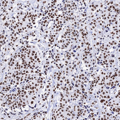 Histone H3 (acetyl K4 + K9 + K18) Rabbit polyclonal antibody