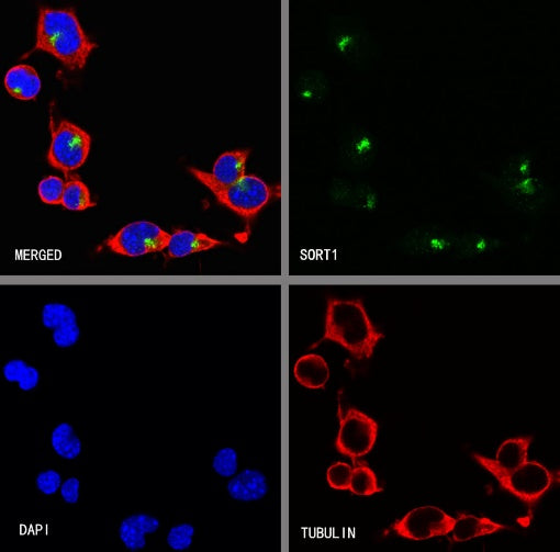 SORT1 Recombinant Rabbit mAb (S-2233-47)