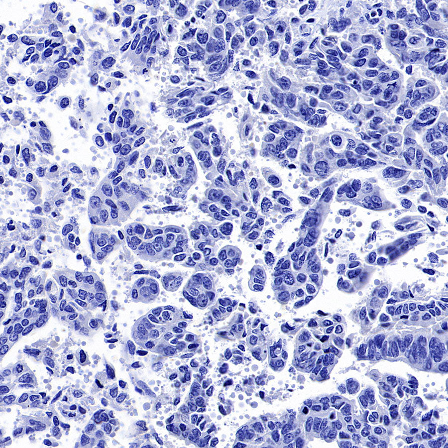 GABRA1 Recombinant Rabbit mAb (S-3254-10)