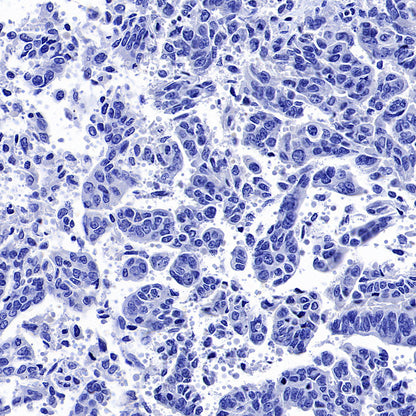 GABRA1 Recombinant Rabbit mAb (S-3254-10)