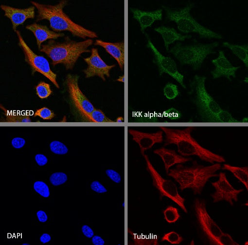 IKK alpha/beta Recombinant Rabbit mAb (S-1317-27)