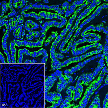 CK-LMW Recombinant Rabbit mAb (SDT-P003)