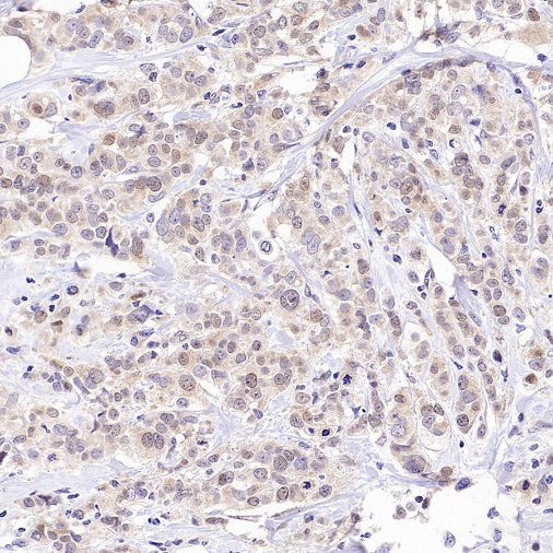 Caspase-2 Recombinant Rabbit mAb (S-3188-3)